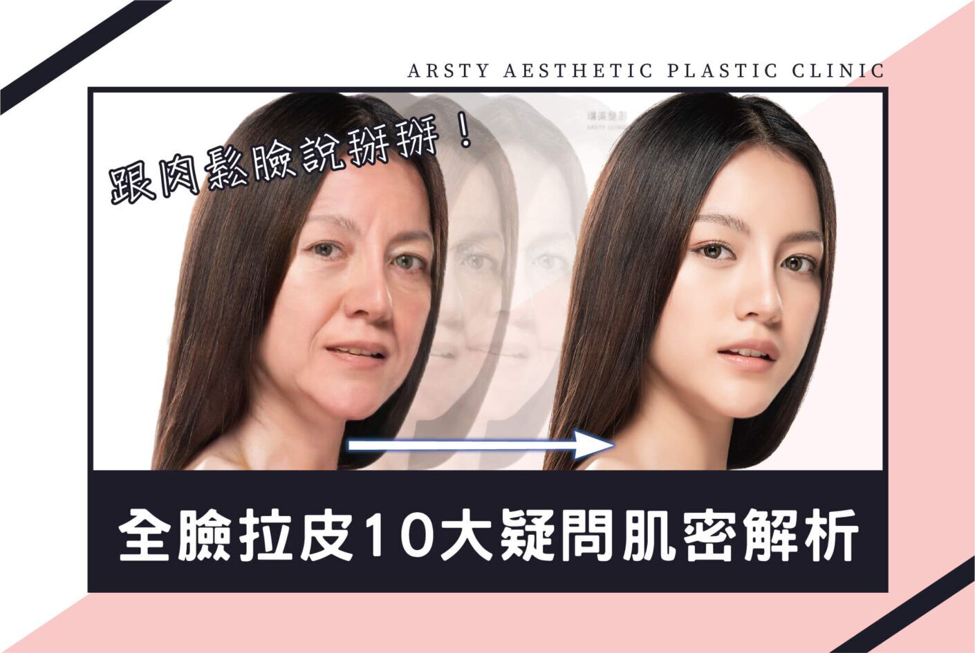 告別肉鬆臉全臉拉皮10大疑問