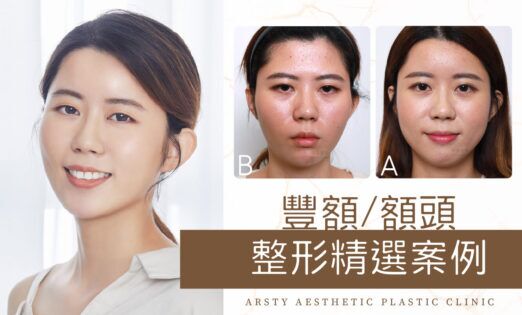 局部案例-豐額、額頭整形封面