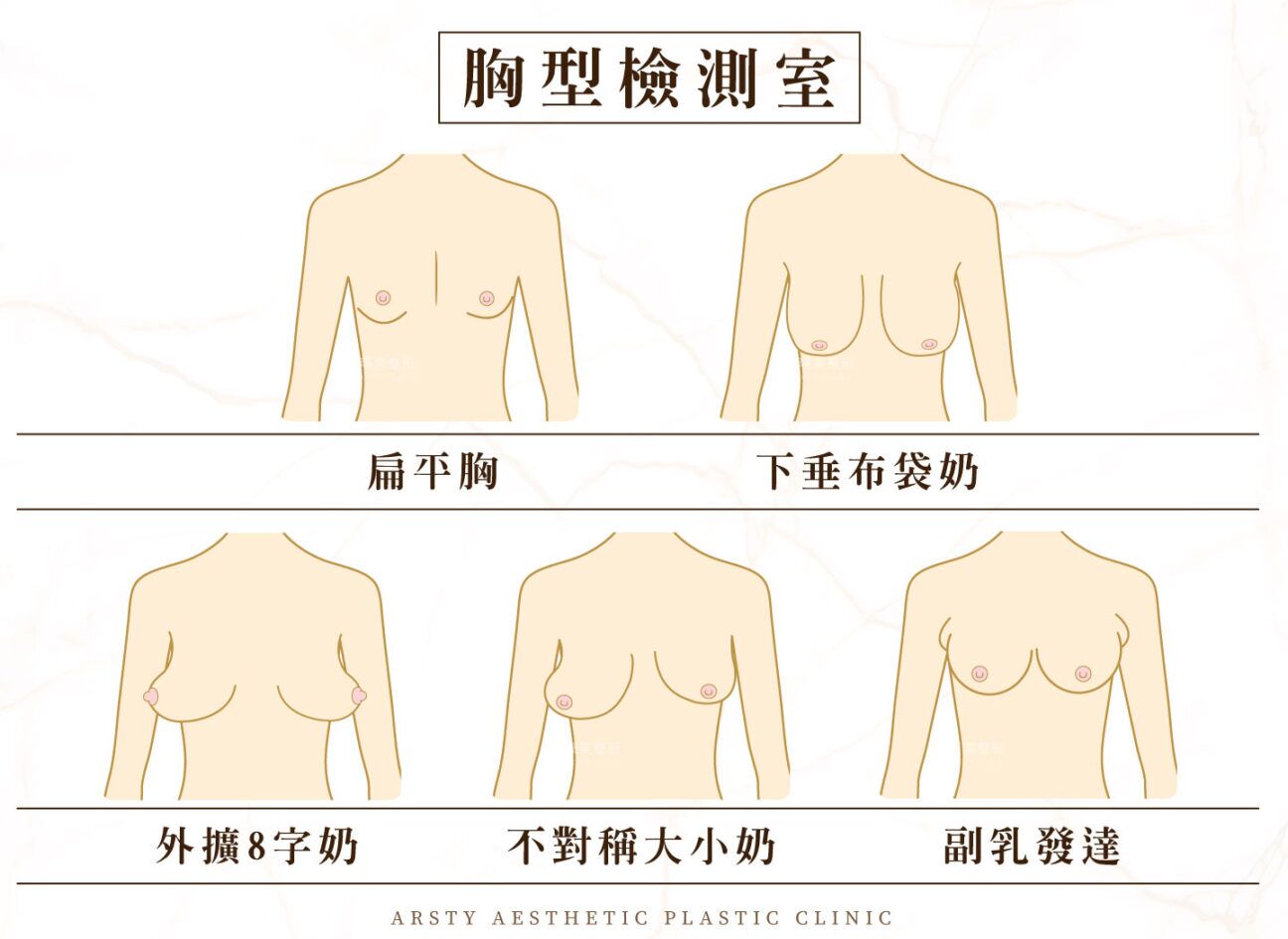 胸型檢測室隆乳手術可以改善大小奶布袋奶等問題 胸型檢測室隆乳手術可以改善大小奶布袋奶等問題