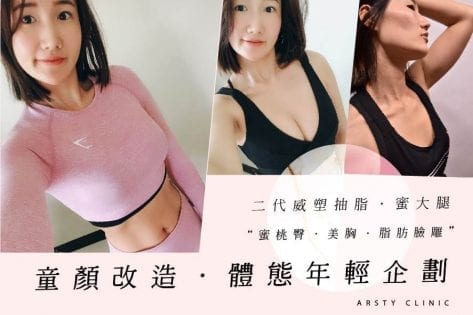 二代威塑抽脂抽脂手術威塑抽脂手術璞美醫美威塑抽脂價錢推薦威塑抽脂荊偉政醫生余德毅醫師威塑抽脂術後威塑心得抽脂後遺症抽脂疤痕抽脂風險抽脂手術費用抽脂會痛嗎腹部環脂費用全身抽脂價格大腿環抽全身抽脂dcard推薦抽脂ptt推薦台北抽脂