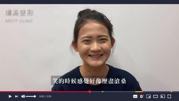 眼袋淚溝黑眼圈術前_B220605_0004_影片截圖_3 H 眼袋 影片截圖 3