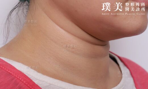 IMG_450_脖紋局部 IMG 450 脖紋局部